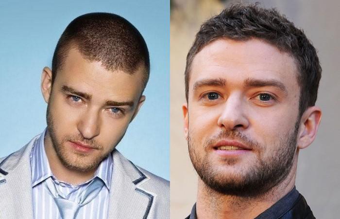 Мужская причёска «Ёжик»: кому подходит, правила выполнения и секреты укладки