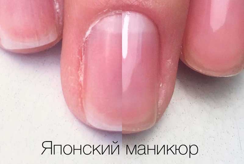 восстановление ногтей после гель лака — это не работает
