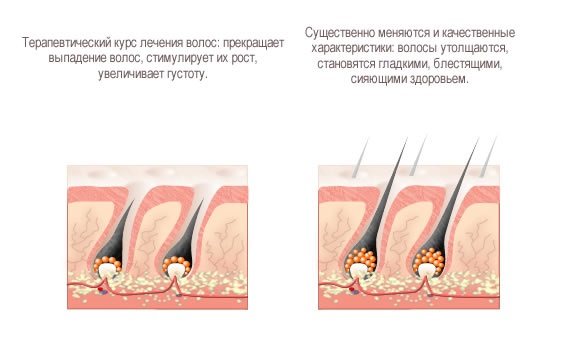 Ампулы для роста волос и от выпадения для женщин. Рейтинг топ-10 комплексов в ампулах