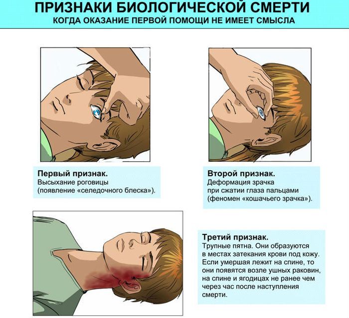 Биологическая смерть фото