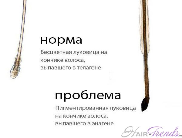 Что делать, если выпадают волосы с белым кончиком