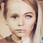 Что случилось с лицом и фигурой Анны Хилькевич: фото до и после пластики