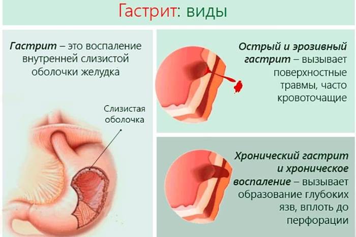 Диета на овсянке. Отзывы и результаты минус 10 кг, меню, быстрая и эффективная, фото до и после