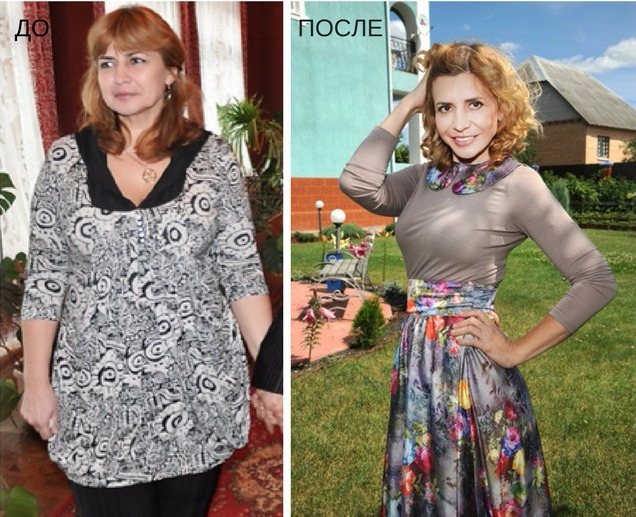Татьяна Строкова до и после пластики: какие операции делала звезда Дома-2 из Воронежа