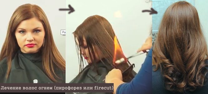 до процедуры и после
