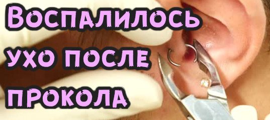Если проколоть хрящик в ухе последствия. Болят хрящи ушной раковины