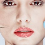 Филлеры в скулы — отличная альтернатива пластической хирургии