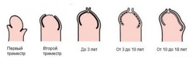 Как открыть головку полового члена