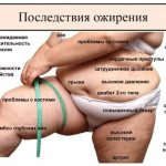 Как убрать ушки на бедрах за неделю: упражнения, липосакция, баночный массаж, обертывания
