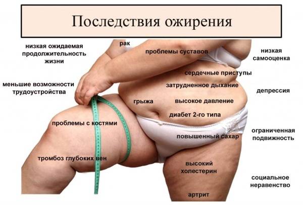 Как убрать ушки на бедрах за неделю: упражнения, липосакция, баночный массаж, обертывания