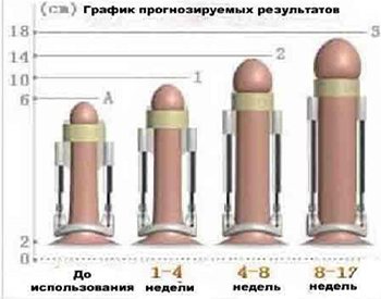 как увеличить член в домашних условиях быстро