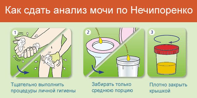 Как вылечить цистит или почему цистит возвращается