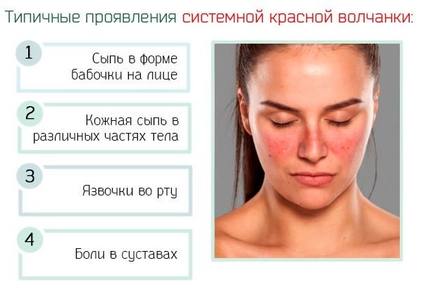 Красные щеки у взрослого. Причины, почему горят, лечение, признаки болезни