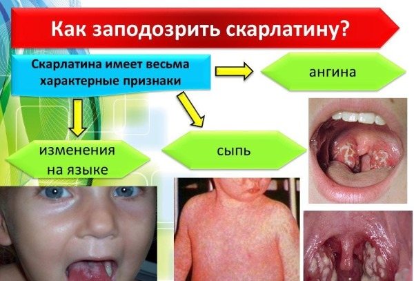 Красные точки на теле - что это, причины, как лечить у взрослых, беременных и детей