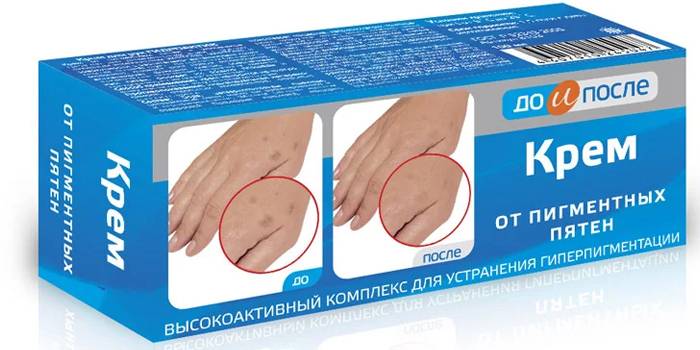Крем от гиперпигментации