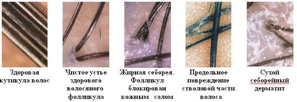 Londa (Лонда) краска для волос - профессионал палитра цветов, фото, отзывы