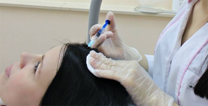 Мезотерапия для избавления от перхоти