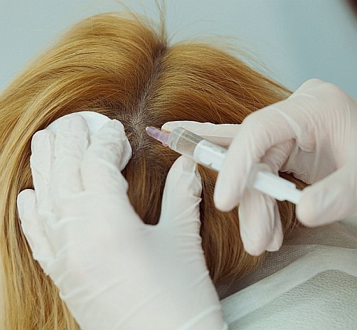 Мезотерапия – современный способ лечения