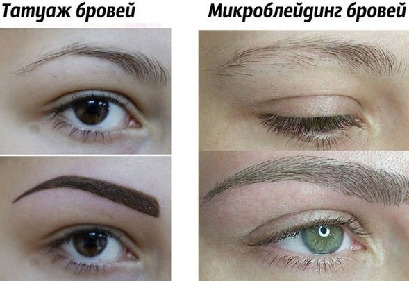 Микроблейдинг бровей. Фото до и после, что это, сколько держится, как делается, цена