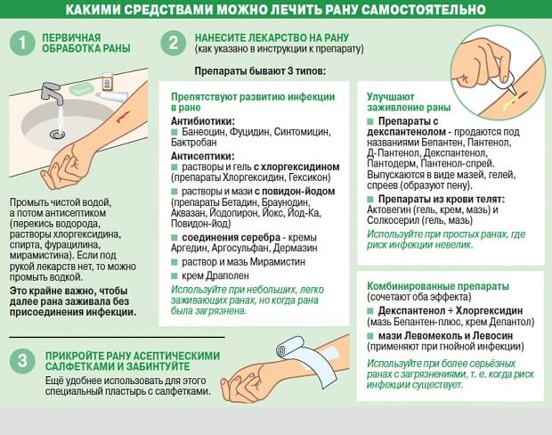 Глубокий порез пальца: порезать, что делать, как лечить