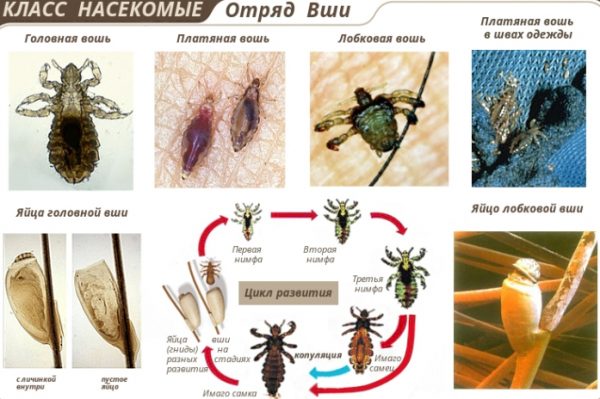 Педикулёз признаки, лечение и профилактика