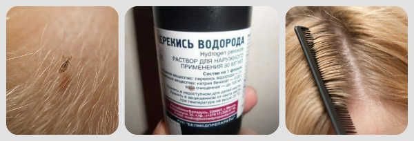перекись