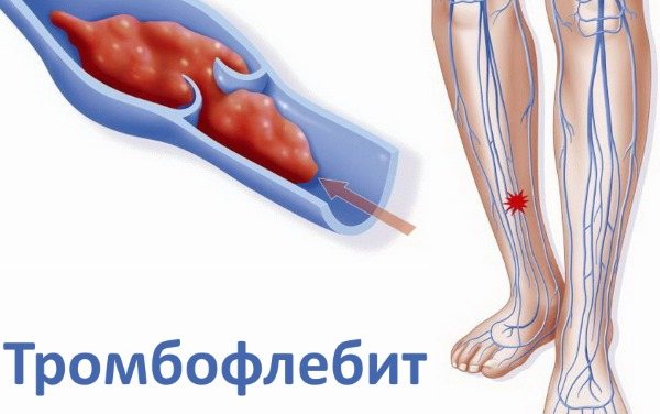 Похудение для ленивых за короткий срок без диет, упражнений, с помощью соды, валика из полотенца, таблеток, киви, на воде