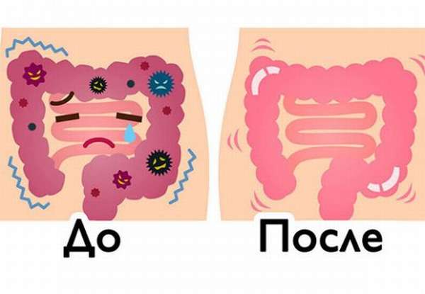 Полное очищение кишечника