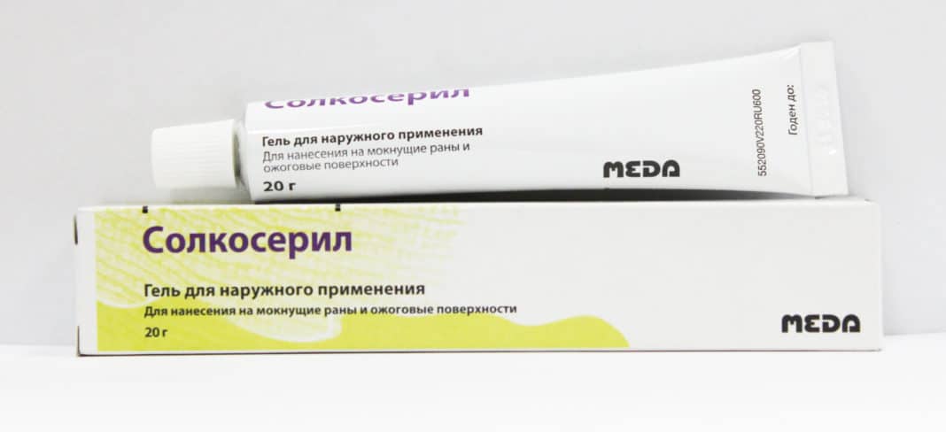 Порез ладони