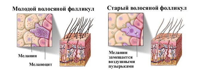 Что делать с сединой на темных волосах: советы и идеи как скрыть
