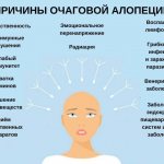 причины очаговой алопеции