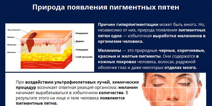 Природа появления пигментных пятен