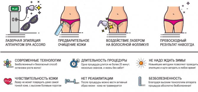 ТОП-6 лучших лазерных эпиляторов для домашнего применения – особенности выбора лазерных