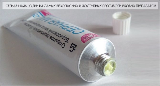 Серная мазь - один из самых доступных препаратов на рынке