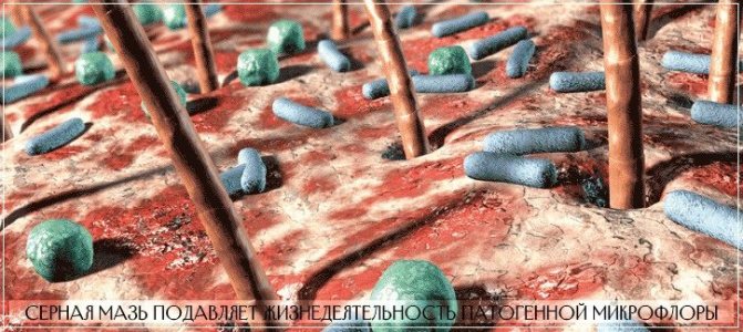 Серная мазь подавляет жизнедеятельность патогенной микрофлоры