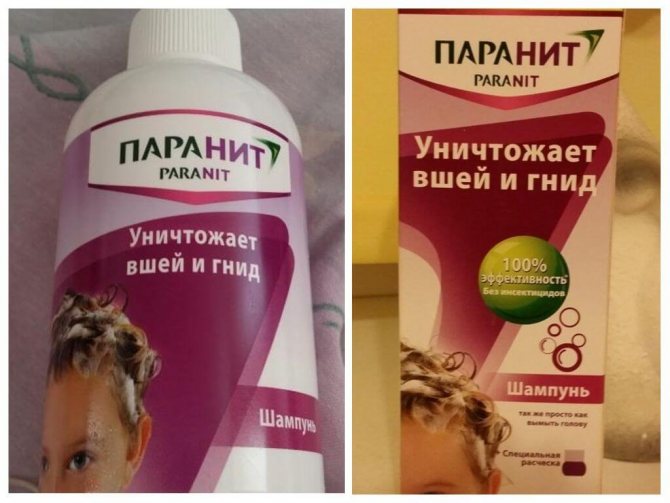 Как избавиться от вшей и гнид навсегда: современные и народные методы