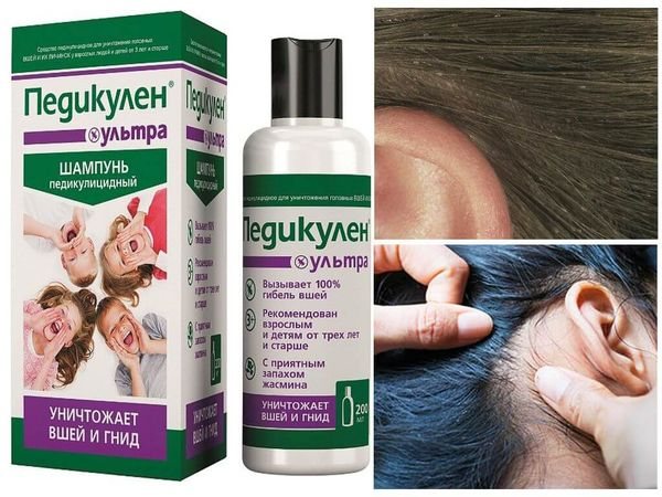 Шампунь Педикулен