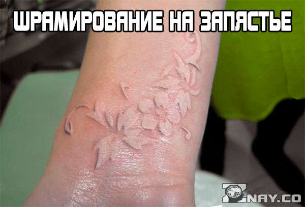 Шрамирование на запястье руки