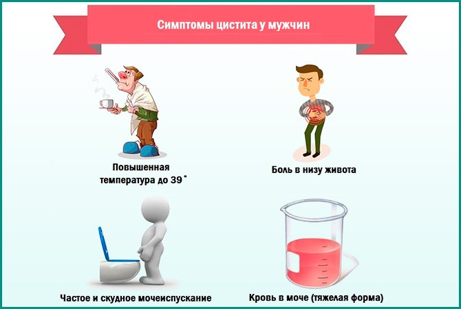Симптомы цистита у мужчин