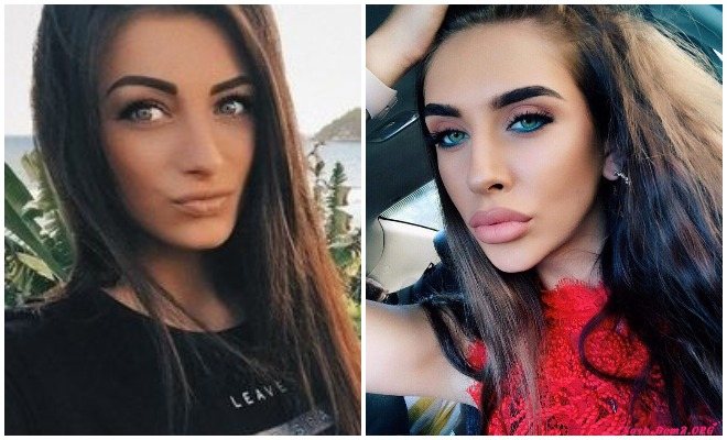 Татьяна Мусульбес до и после пластики