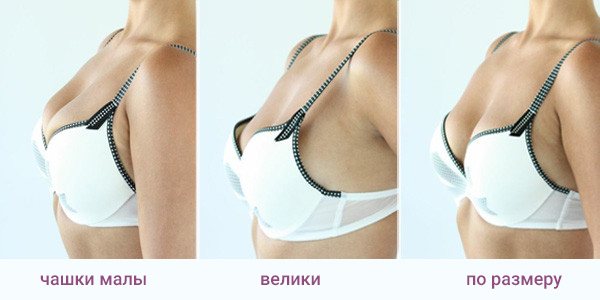 три положения чашек