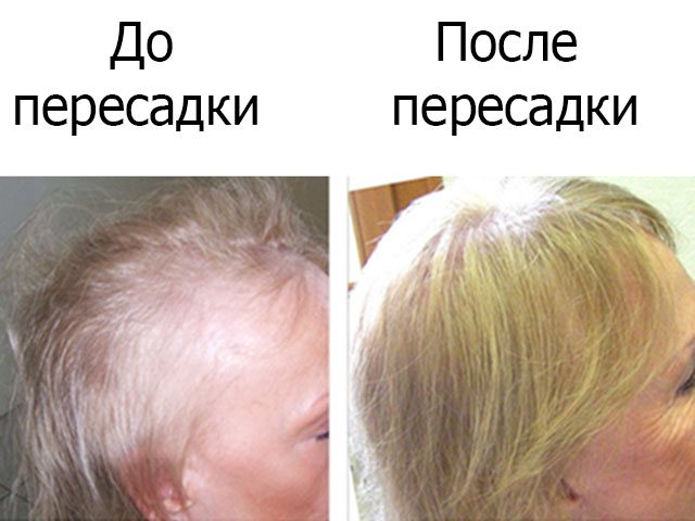 Где берут волосы для наращивания. Откуда берутся волосы для наращивания волос