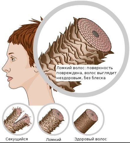 Витамины в ампулах для волос, никотиновая, аскорбиновая кислота, диксон, керастаз. Маски в домашних условиях