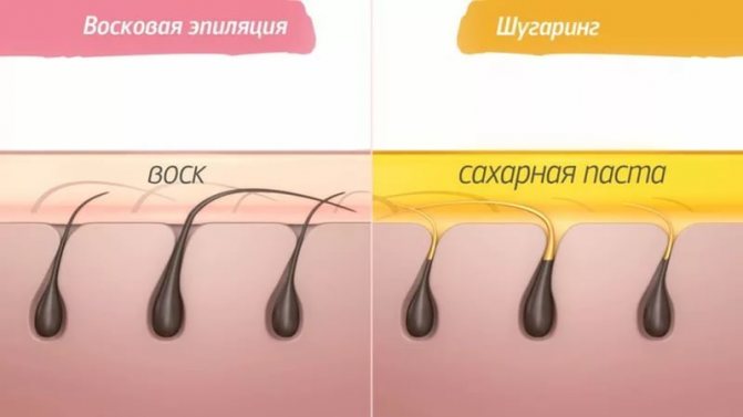 Шугаринг для всех: руководство по депиляции сахарной пастой